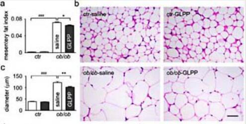 Ganoderma lucidum polysaccharide peptide alleviates hepatoteatosis