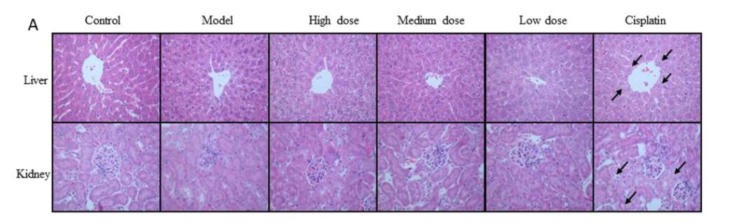 Comparison of anti-tumor effects after Taking Ganoderma lucidum Extract vs Chemotherapy